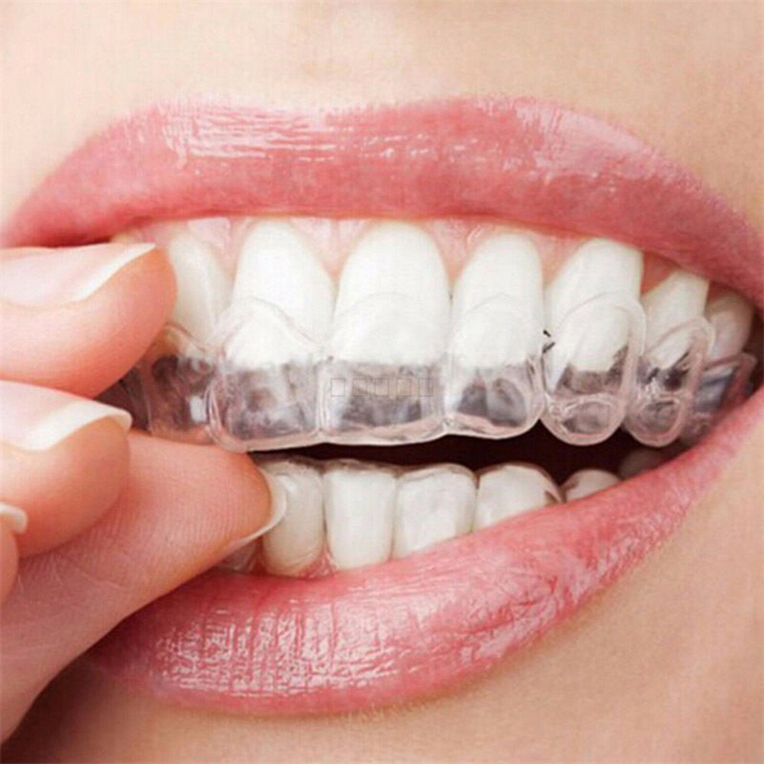 Integrated Oral Care IOC Teeth Grinding Guard