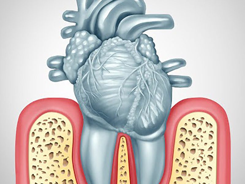 Oral Care Gum Disease and Heart Disease